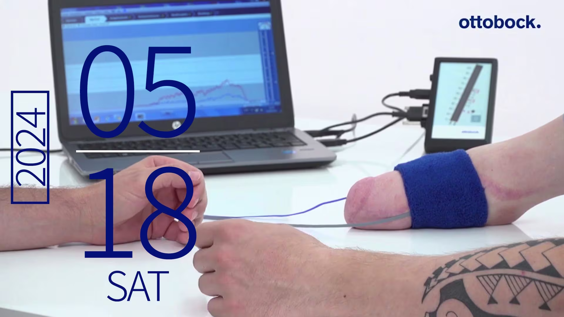 筋電義手セミナー マイオボーイの使い方