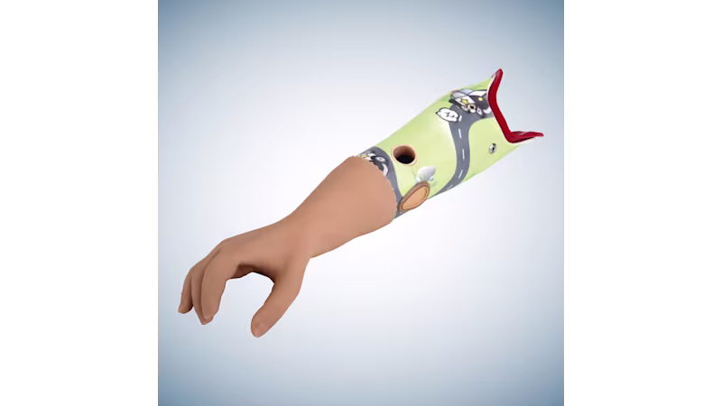 Below-elbow child prosthesis: Ottobock Electric Hand 2000 and MyolinoWrist 2000.