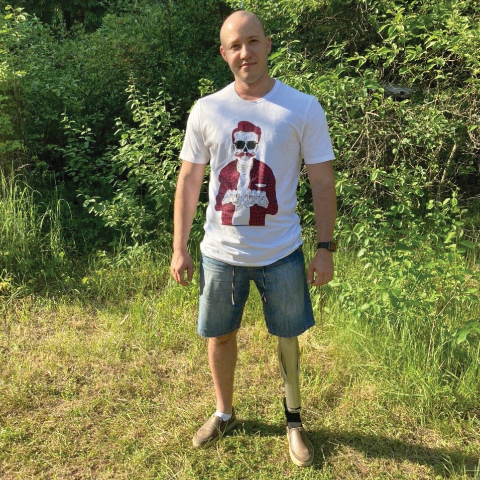 Пользователь протеза бедра стоит на лесной поляне.