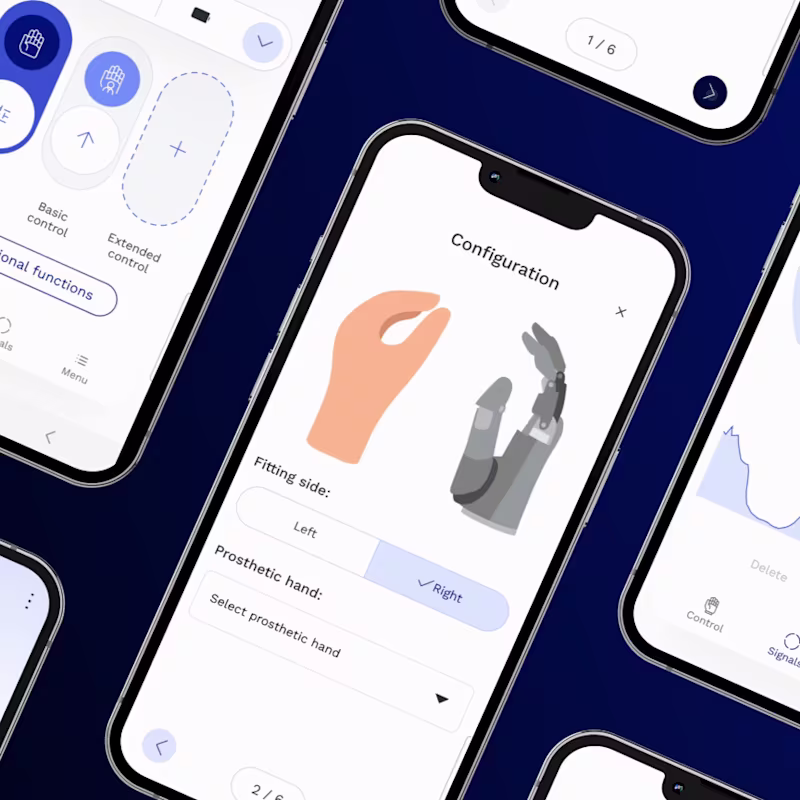 A smartphone shows the connectgrip app.