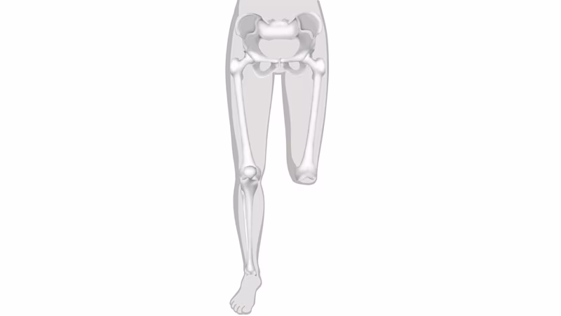 FirstSpiritExport,OBISCM-1557,web_site,prosthetics_2,infos_for_amputees