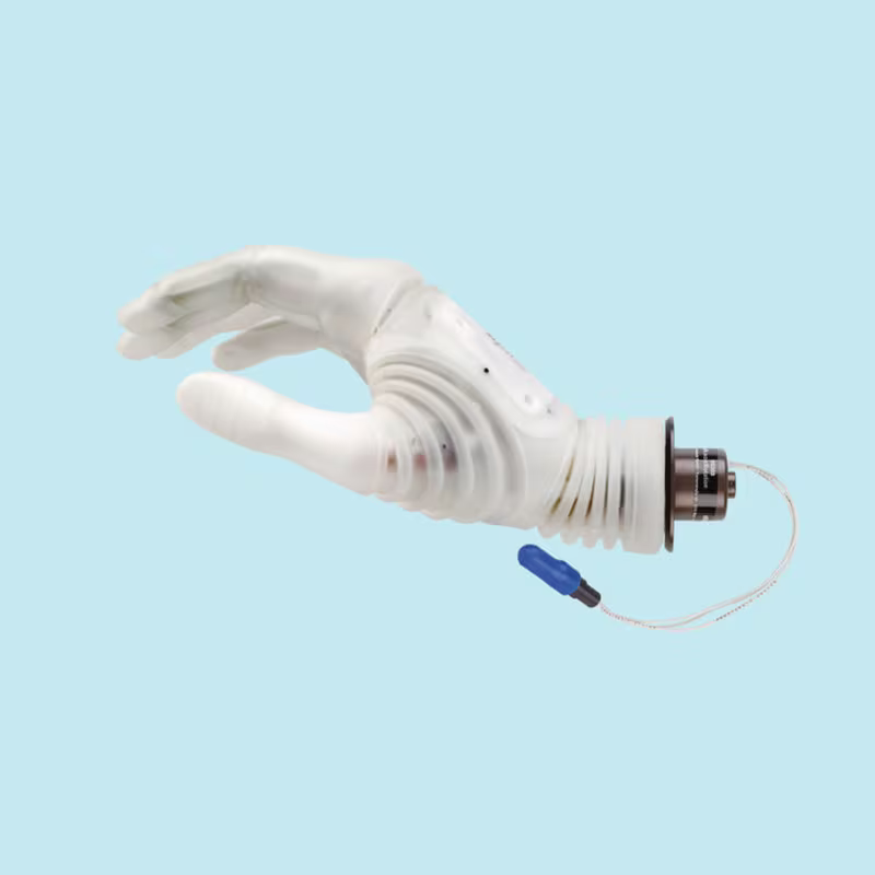 Hier werden die Michelangelo Hand und das Axon Bus Prothesensystemvon Ottobock für einen Armprothesenträger gezeigt.