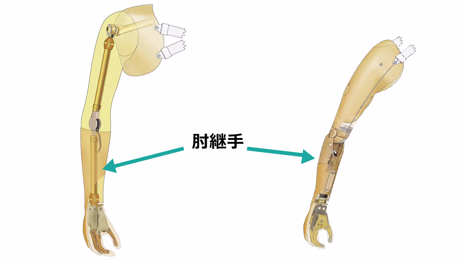 義手パーツ 構造と仕組み 肘継手 上腕義手 骨格構造/殻構造 12K42/12K19/12K5/12R6/12R7 屈曲/伸展 外転/内転 ロック/アンロック機能