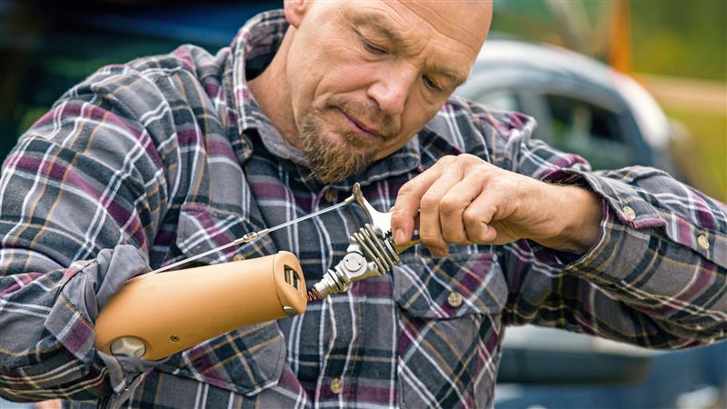Prosthetic hands and arms for performance-driven users - User stories - Holger 