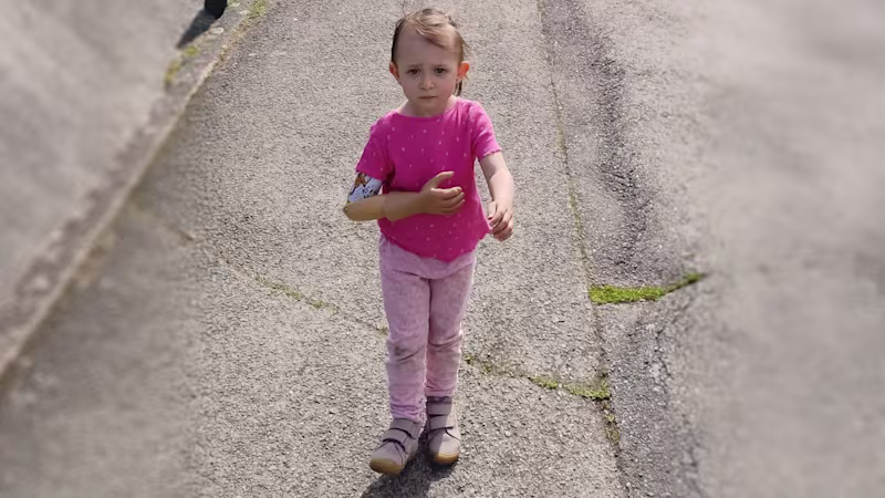 Verunka-2400x1344-4-amputace-hk-u-deti