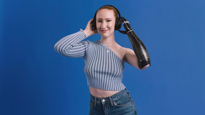 Eine Armprothesenträgerin hört Musik und hält Ihre Hände an den Kopfhörern. Sie trägt die bebionic Hand von Ottobock.