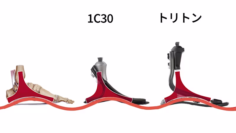 義足足部 トリトン1C61/1C62/1C63/1C64/1C68 高活動 カーボン構造