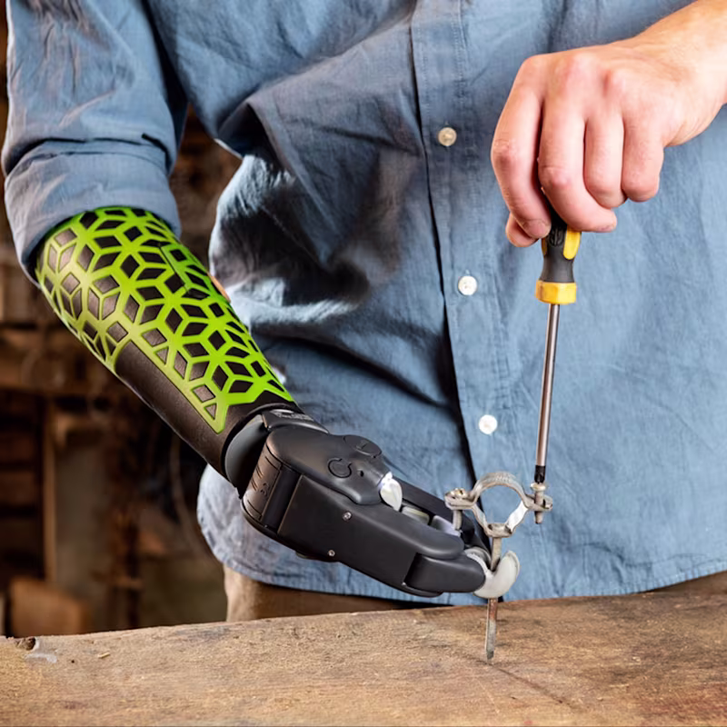 A myoelectric prosthetic hand user holding a nail while using a screwdriver with their biological hand