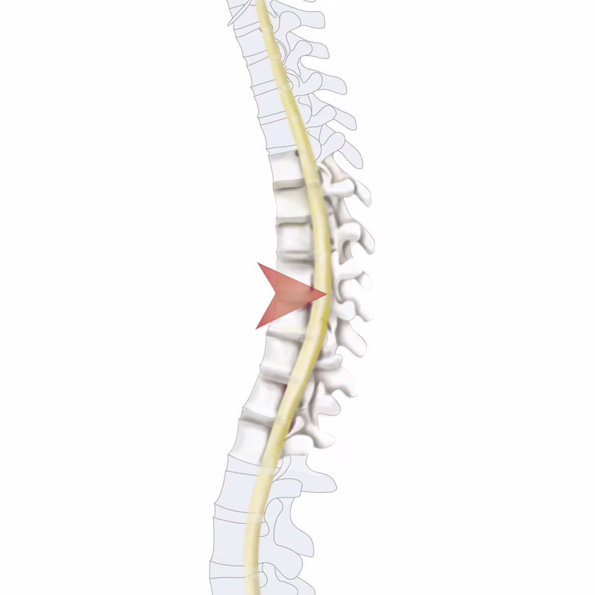 -35273 Querschn 11-4c wb(1443110) en