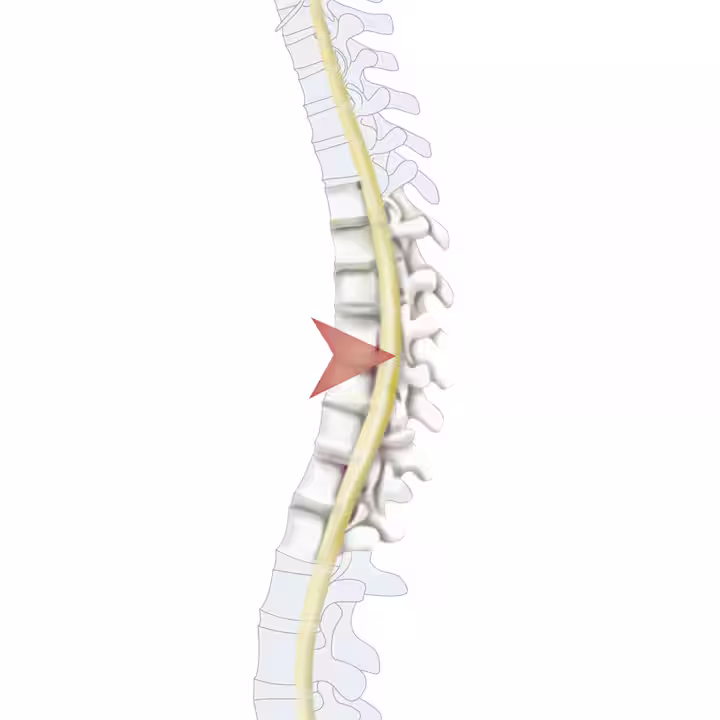 -35273 Querschn 11-4c wb(1443110) en