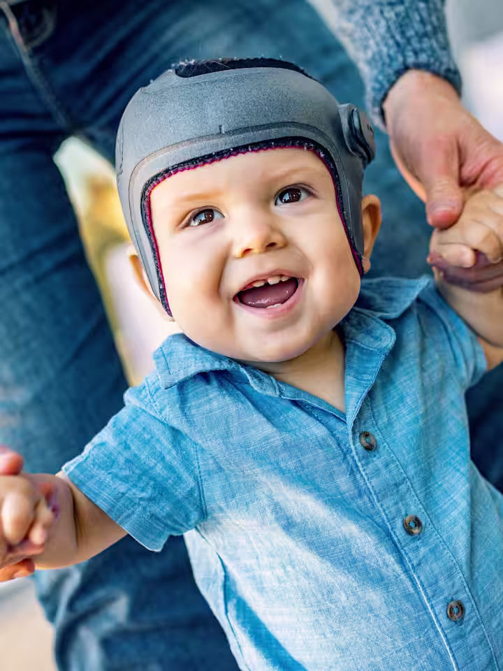 A child wearing the MyCRO Band cranial helmet