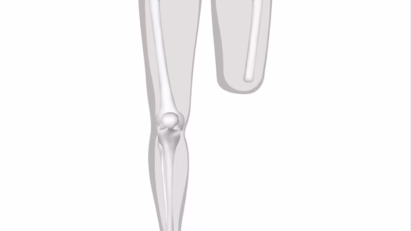 FirstSpiritExport,OBISCM-1557,web_site,medicalcare,prostheses___faqs