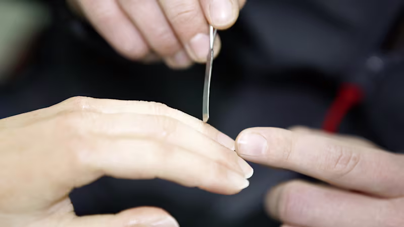 FirstSpiritExport,OBISCM-1557,web_site,service_fabrication,upper_limb_2,silicone_cover