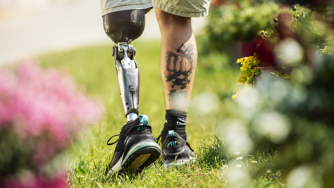 What to Know About Prosthetics