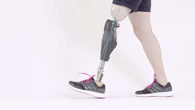 FirstSpiritExport,OBISCM-1557,web_site,prosthetics_2,lower_limb_1,mpk_know_the_difference,opg