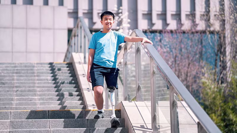 dynion explore mechanical prosthetic knee