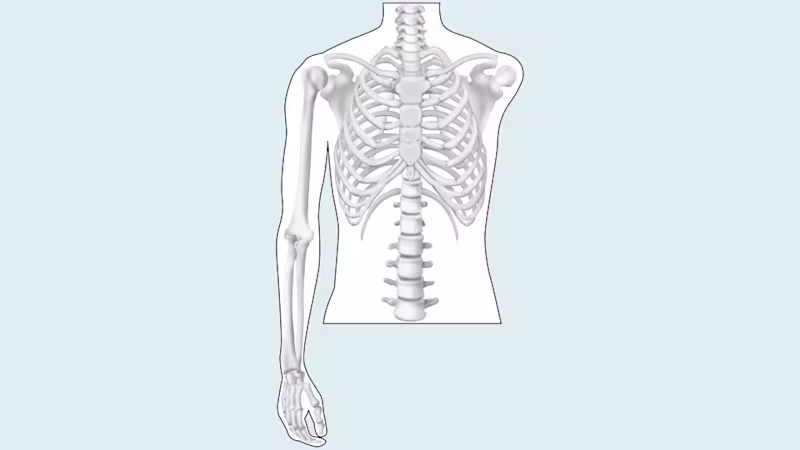amputation level upper limb drawing 16 9 content-2