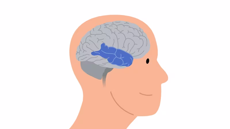 Grafika ľudskej hlavy a mozgu, na ktorej sú oblasti mozgu postihnuté dyskinézou zvýraznené modrou farbou
