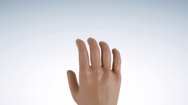 Prosthetic hands and arms for casual users - Casual combinations for below-elbow limb differences - mHand Adapt (AU)