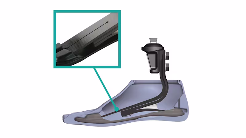 義足足部 トリトン1C60 スプリットトウ カーボン構造