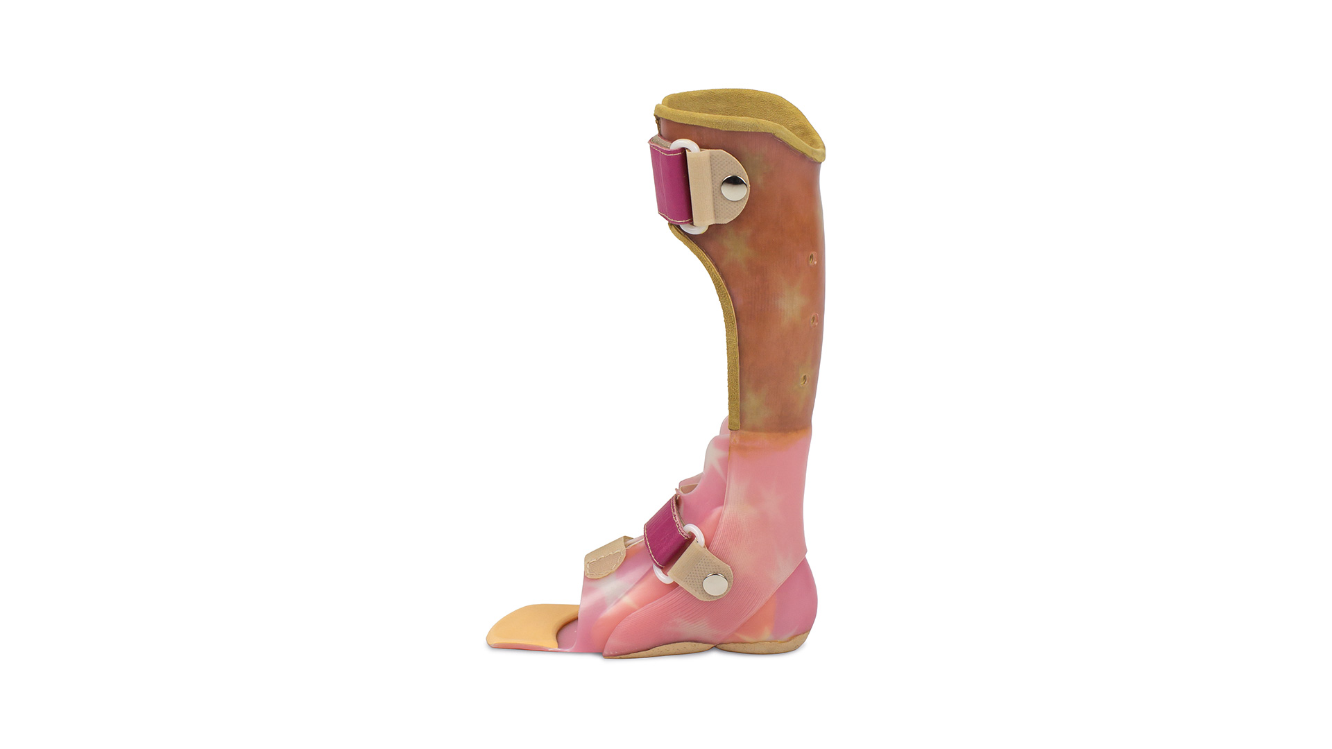 Индивидуальный тутор на голеностопный сустав