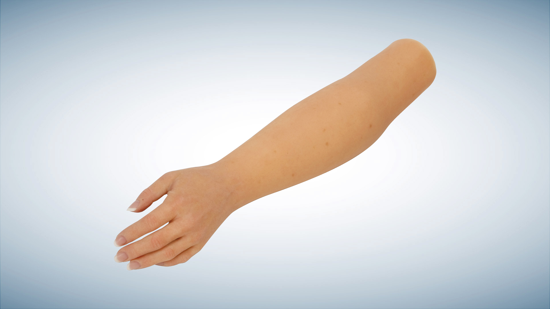 Ottobock Passive Elbow prosthetic component for functional arm positioning.