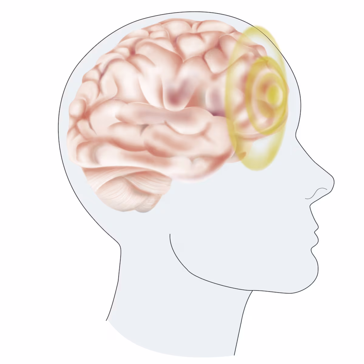 -35272 SHT--169-col(1443106) en