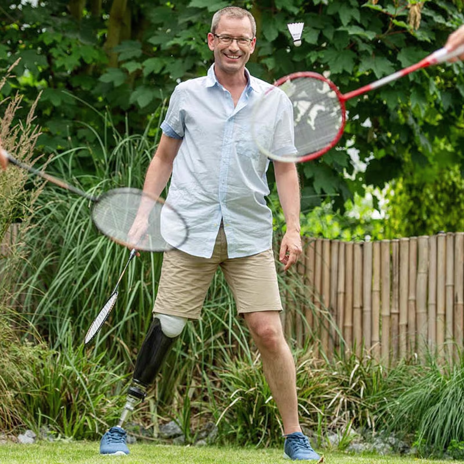 義足足部1C58タレオサイドフレックス カーボン構造 立位安定