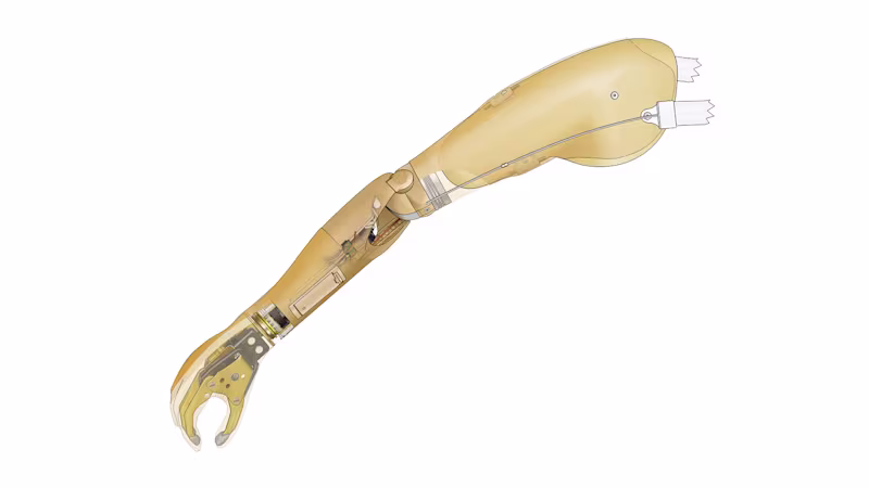 FirstSpiritExport,OBISCM-1557,web_site,service_fabrication,upper_limb_2,silicone_cover