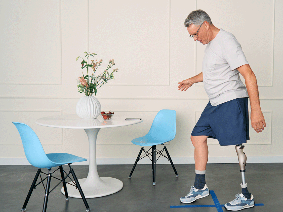 A Kenevo microprocessor-controlled prosthetic knee walking in a clinic