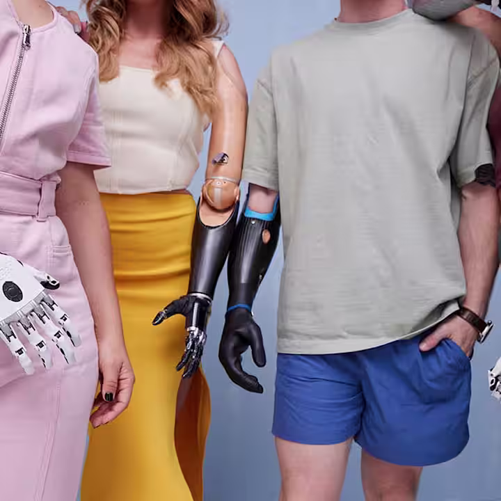 筋電義手ユーザー bebionic ミケランジェロハンド マイオボック