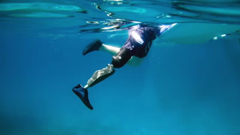 FirstSpiritExport,OBISCM-COM,OB_ISCM_COM_export,media,media,ottobock_corporate,press,2019_02_08_100_jahre_ottobock