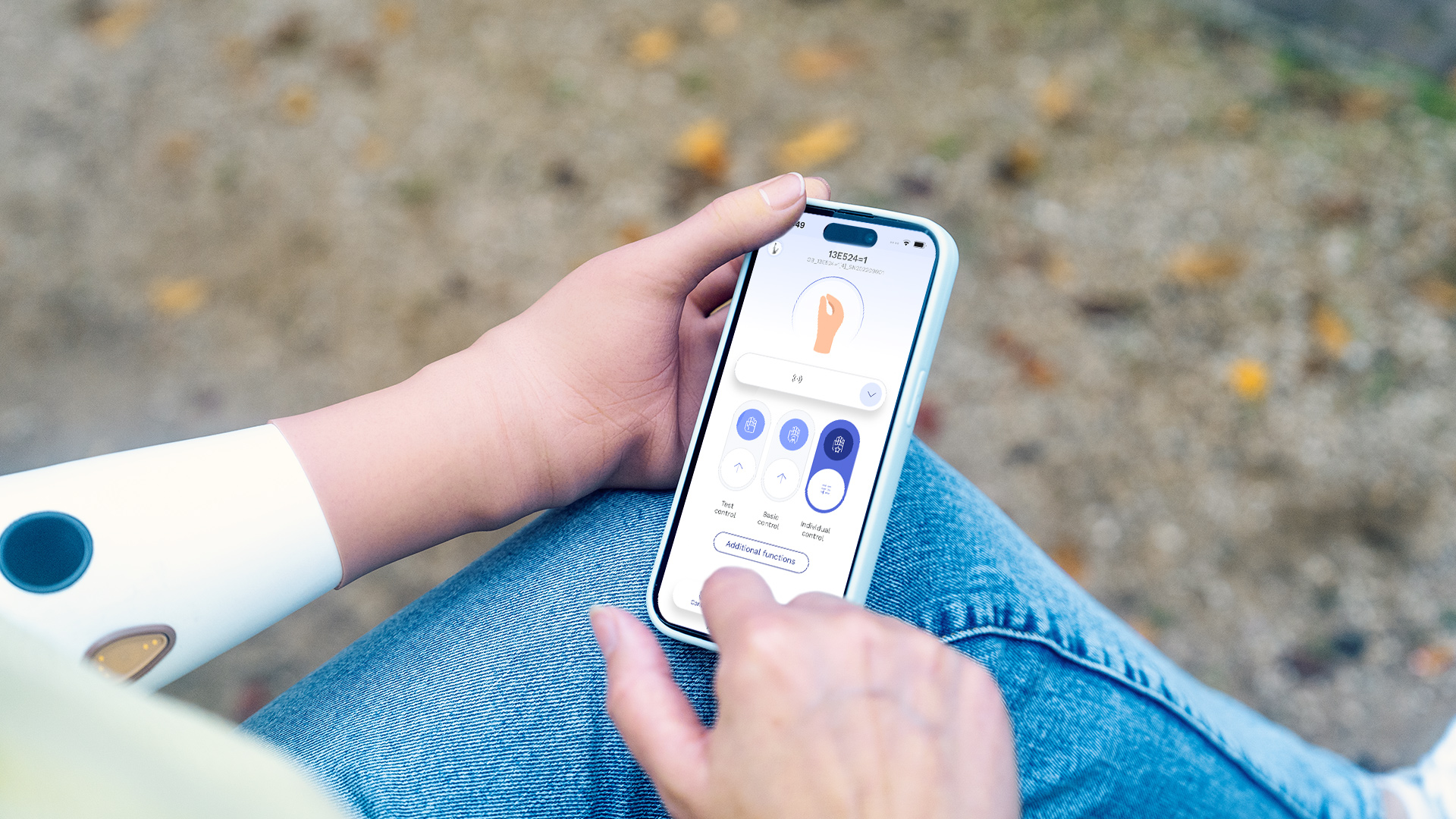 Prosthetic hand user holding a smartphone with the Ottobock connectgrip app on screen.