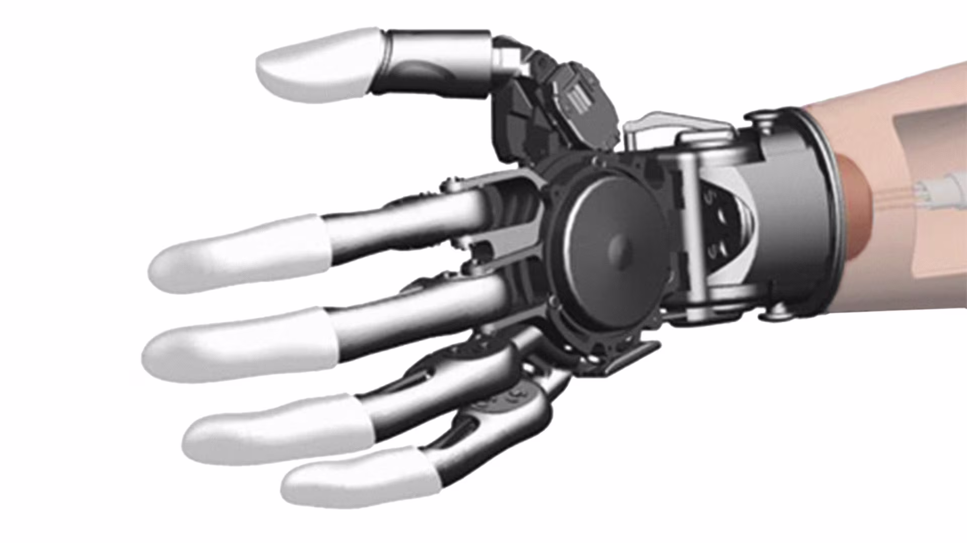 FirstSpiritExport,OBISCM-1557,web_site,prosthetics_2,upper_limb_1,michelangelo