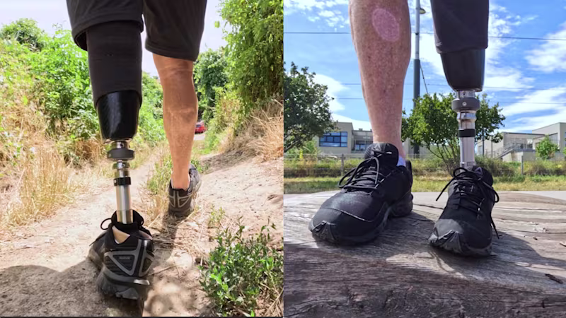 1C70エヴァント 前額面の可動域 ±10°の傾き