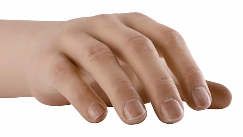 FirstSpiritExport,OBISCM-1557,web_site,service_fabrication,upper_limb_2,silicone_cover