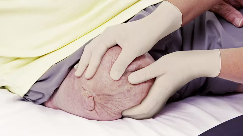 Doctor controls leg stump after amputation