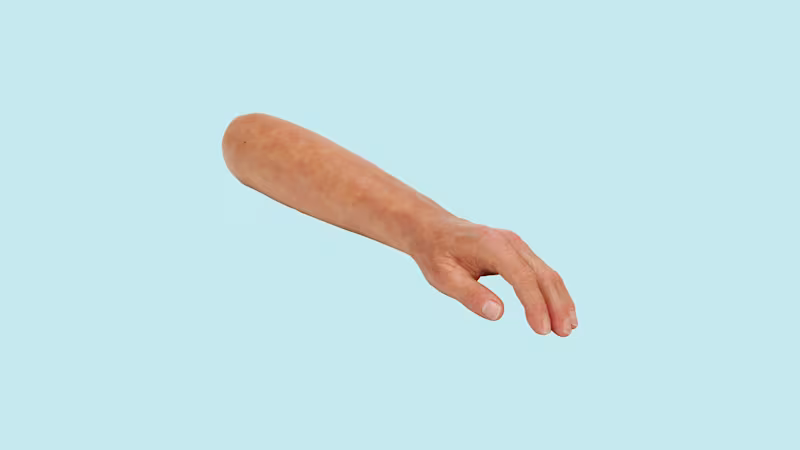 Hier wird die Silikonhand von Ottobock gezeigt