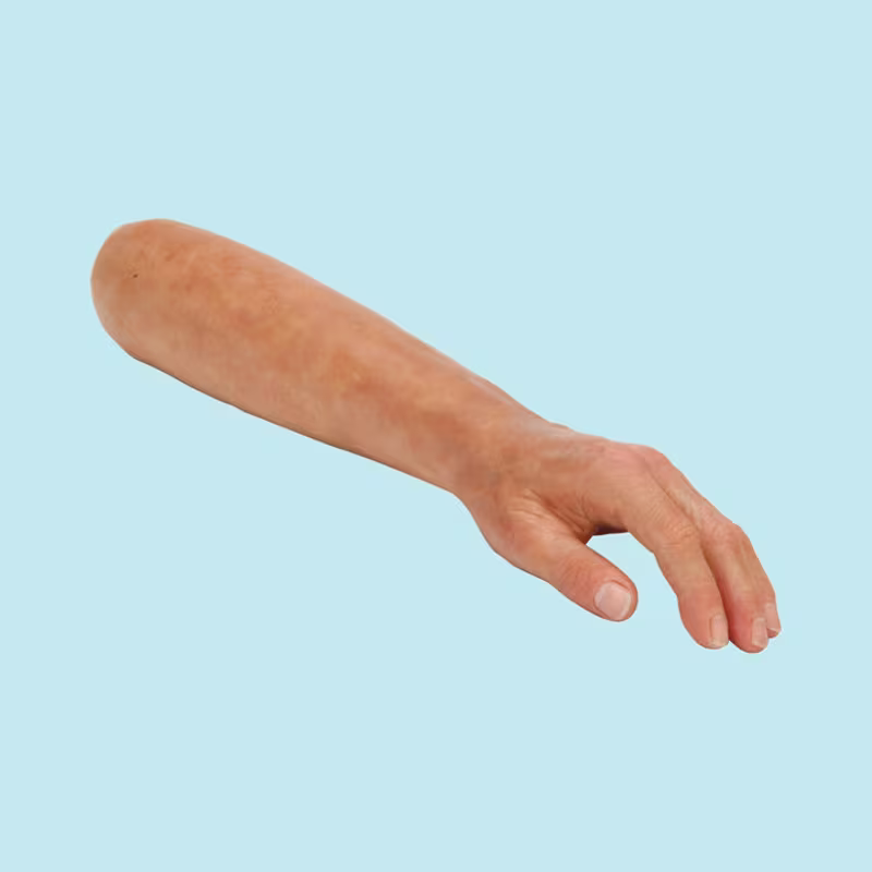 Hier wird die Silikonhand von Ottobock gezeigt