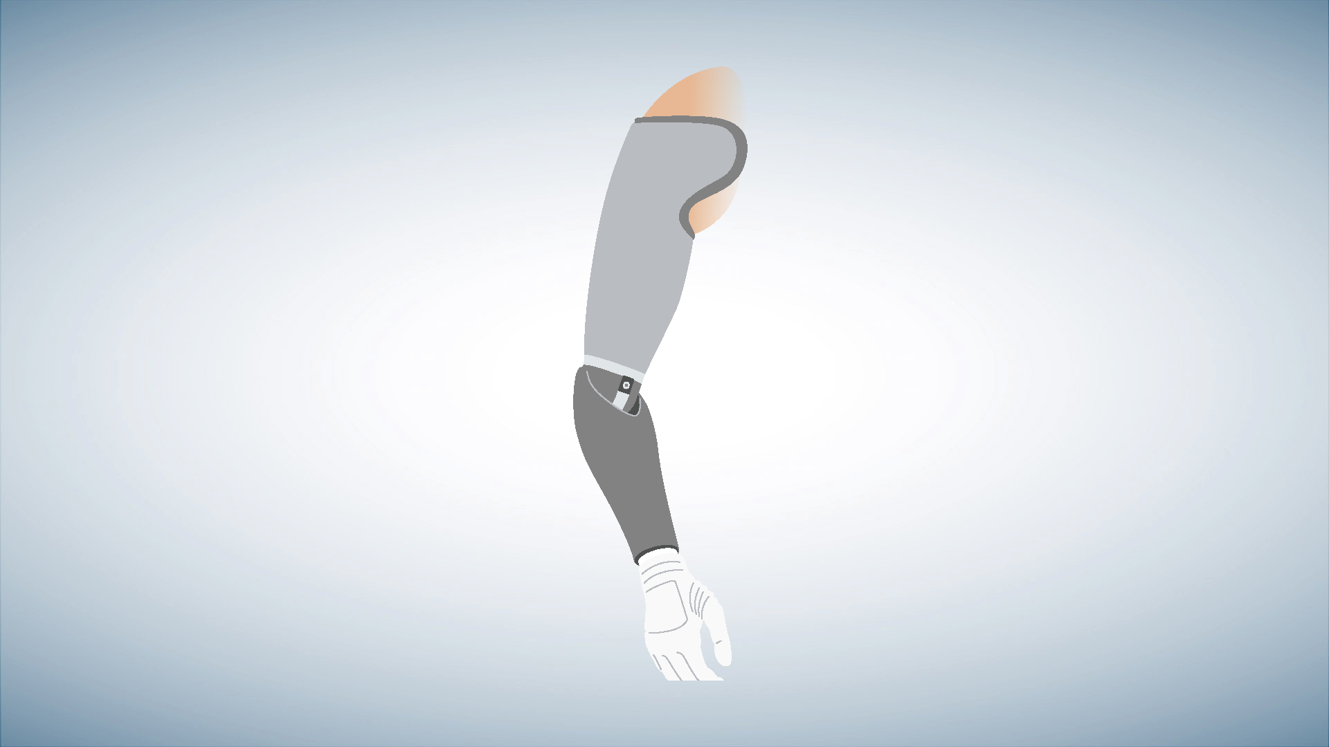 Schematic illustration of an above-elbow prosthesis.