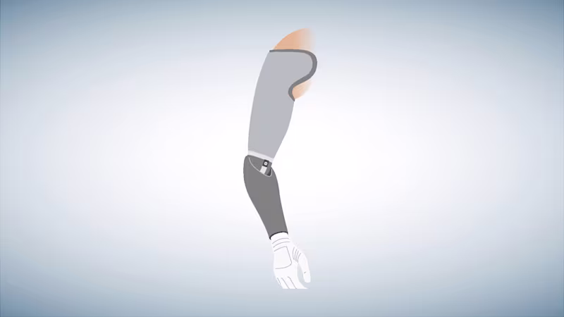 Schematic illustration of an above-elbow prosthesis.