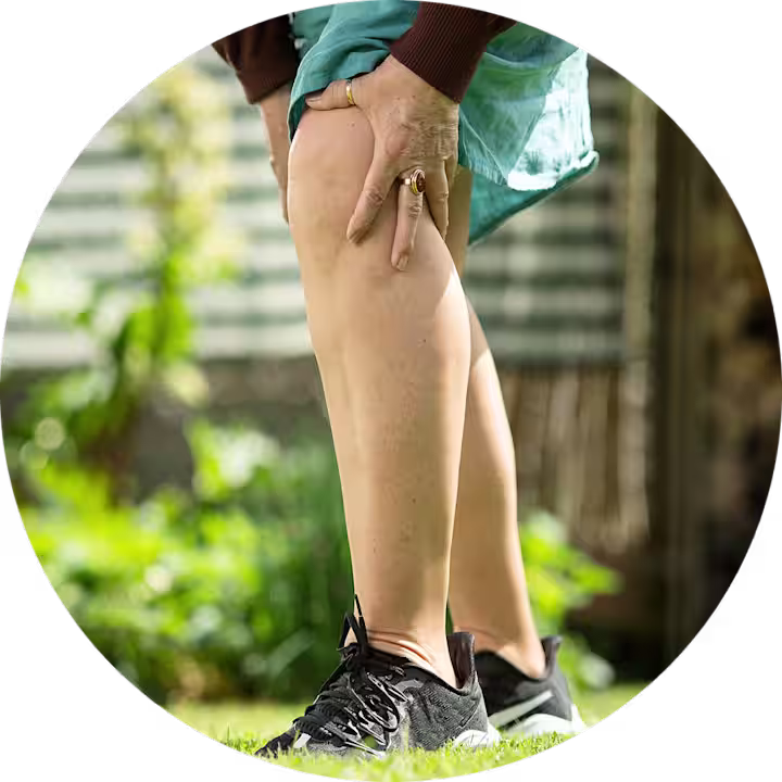 Bildausschnitt von dem Unterkörper einer Frau, die sich vor Schmerzen das Knie hält.