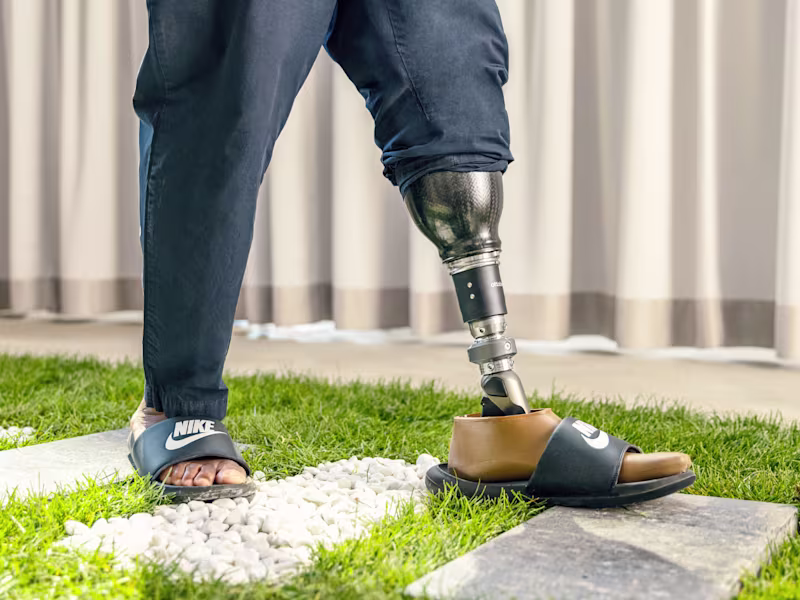 A man wearing a Taleo Adapt prosthetic foot from Ottobock walking across green turf
