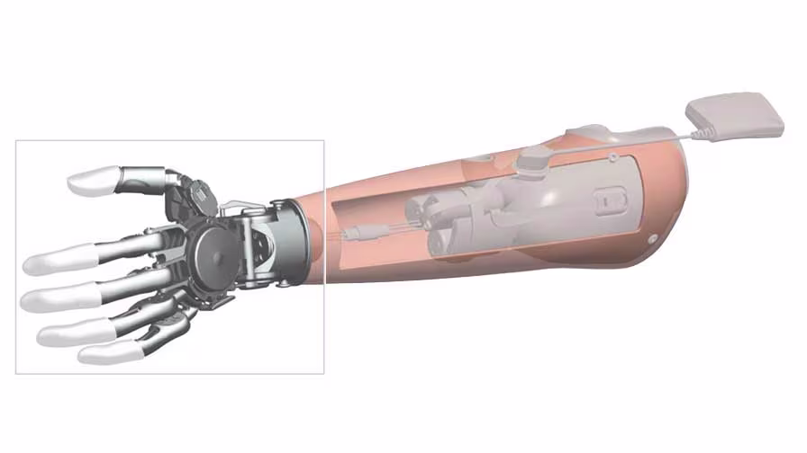 FirstSpiritExport,OBISCM-1557,web_site,prosthetics_2,upper_limb_1,michelangelo