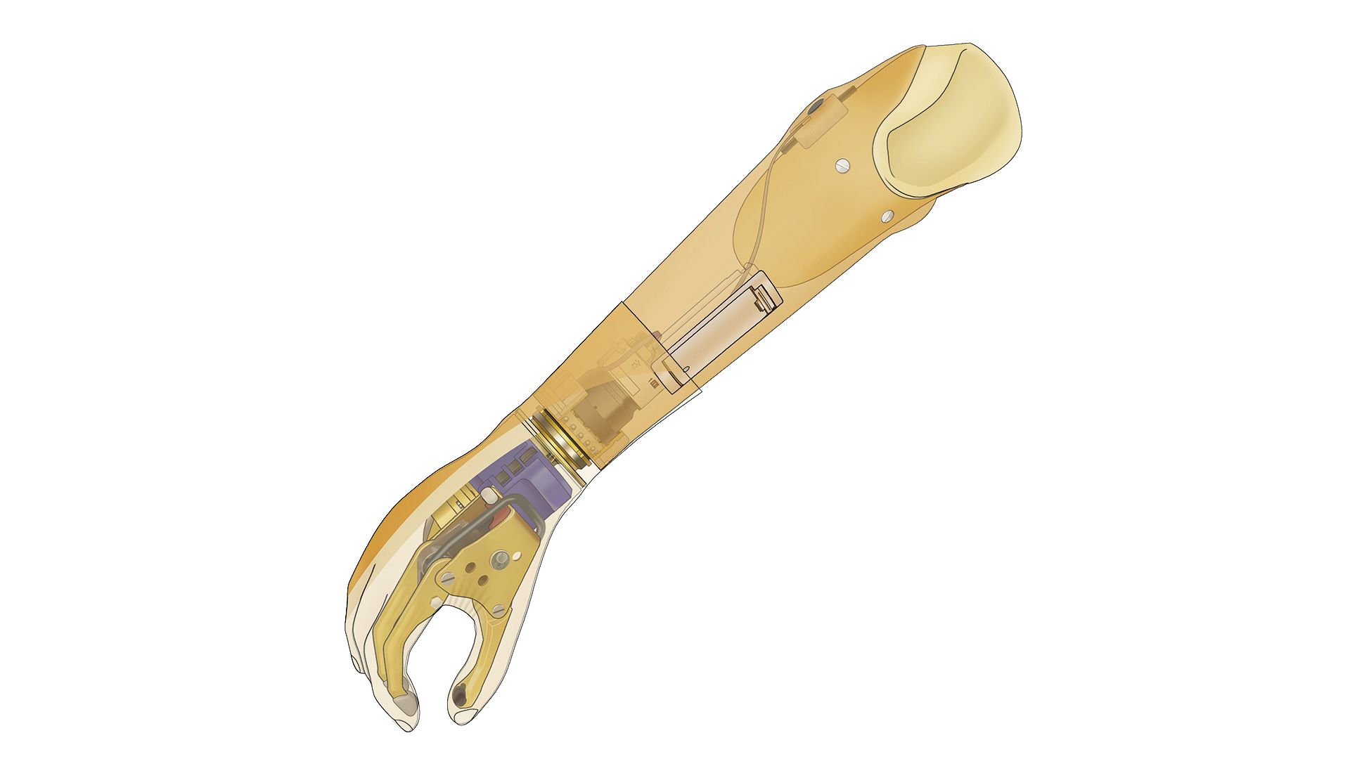FirstSpiritExport,OBISCM-1557,web_site,prosthetics_2,upper_limb_1,myoelectric