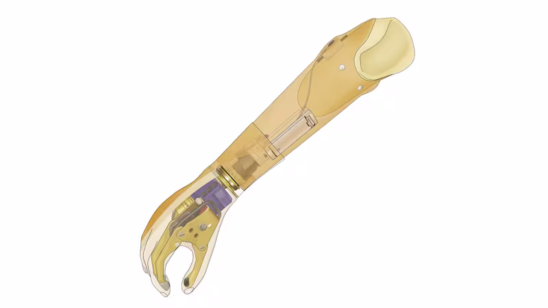 FirstSpiritExport,OBISCM-1557,web_site,prosthetics_2,upper_limb_1,myoelectric