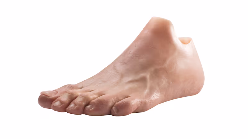 Protesi in silicone per amputazione di avampiede