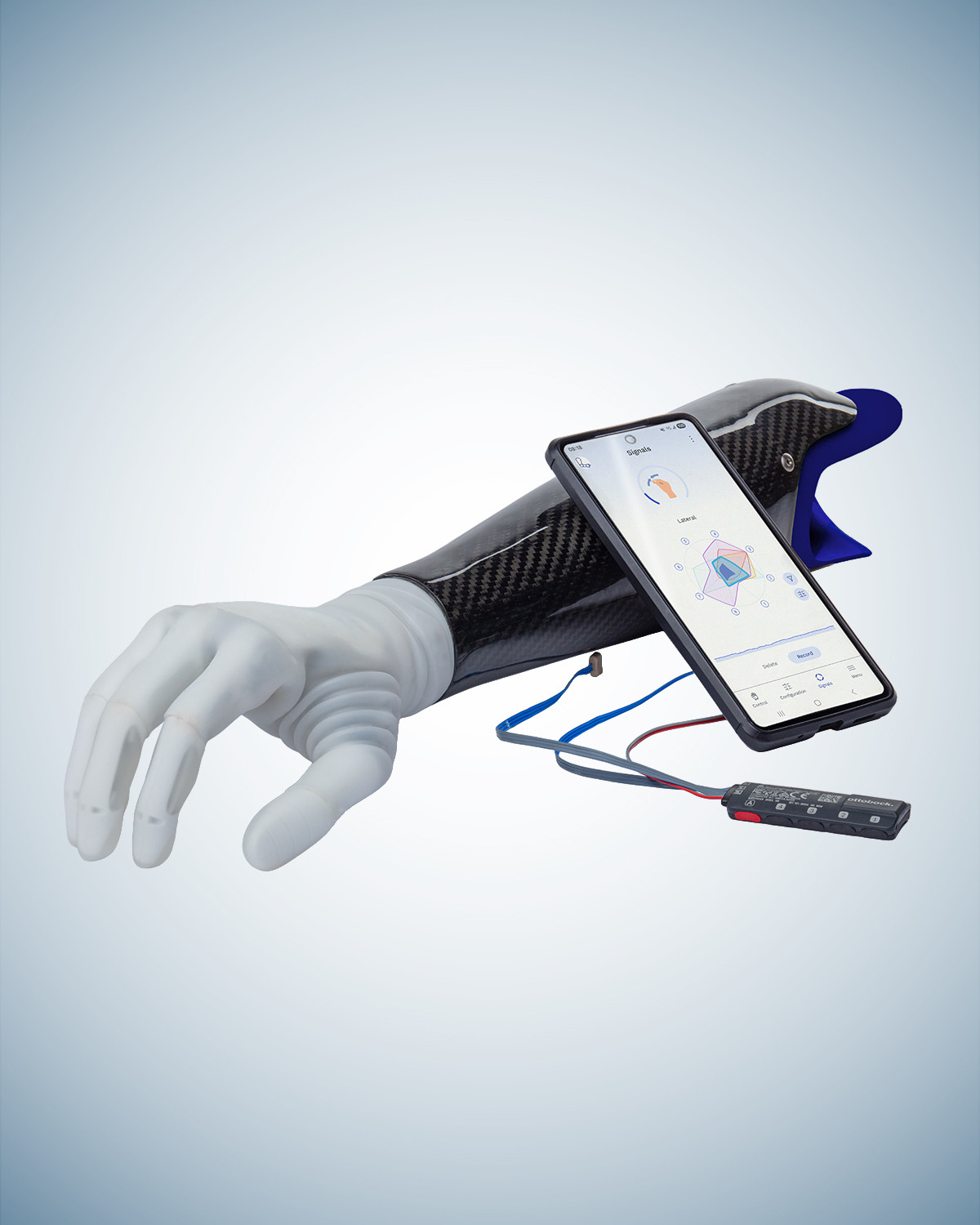 The michelangelo prosthetic hand attached to a socket, placed next to a smartphone displaying connectgrip and the myosmart plus control.