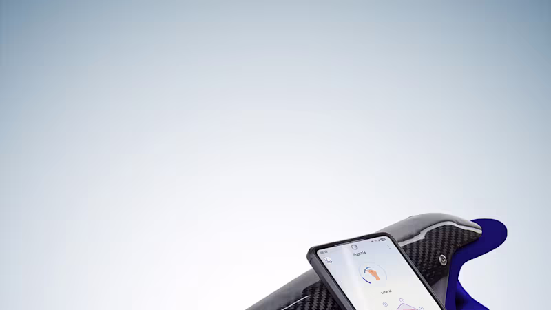The michelangelo prosthetic hand attached to a socket, placed next to a smartphone displaying connectgrip and the myosmart plus control.