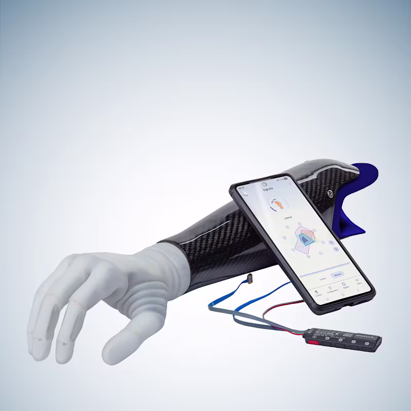 The michelangelo prosthetic hand attached to a socket, placed next to a smartphone displaying connectgrip and the myosmart plus control.